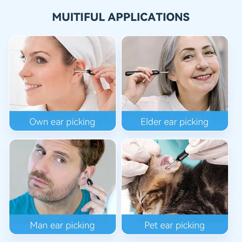 EAR WAX REMOVAL WITH CAMERA  Smart Visual Ear Cleaner with 8MP Wireless Otoscope