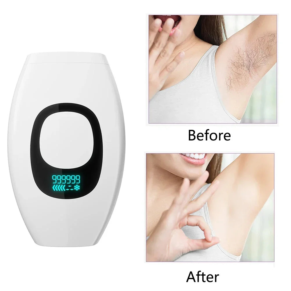 HANDHELD LASER HAIR REMOVAL DEVICE  Effortless, Painless, and Permanent Hair Removal